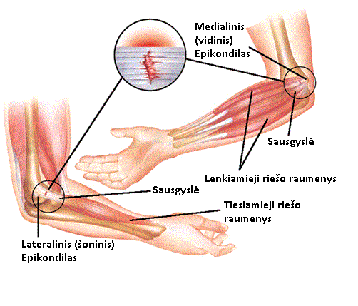 swelling between joints kupono gydymas sąnarių