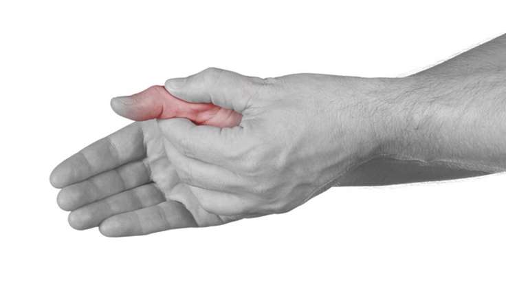 pirmoji pagalba į alkūnės sąnario artritas skauda pirštų sąnarius ant rankų