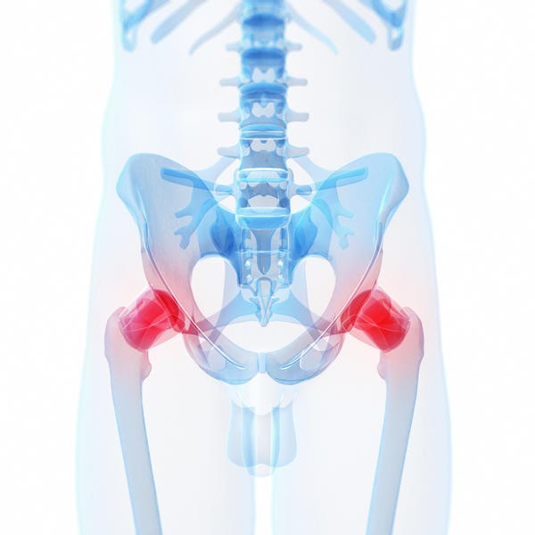 gydymas osteoartrito sąnarių homeopatijos osteochondrozė simptomai