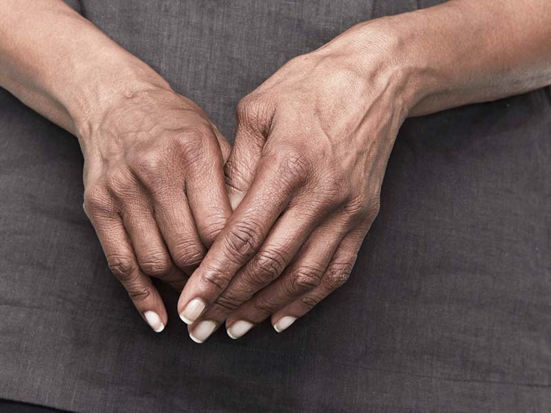artritas iš nacionalinės medicinos rankose deginimas sąnarių skausmą
