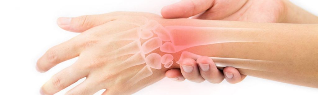 osteoartrito artritu riešų alkūnė skausmas kuris yra