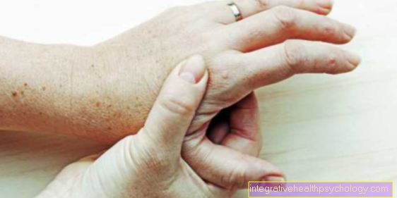 kaip pašalinti uždegimą artritu pirštais poliartritas sąnarių gydymas rankomis