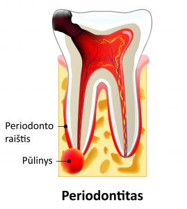 dantų skausmas sąnarių