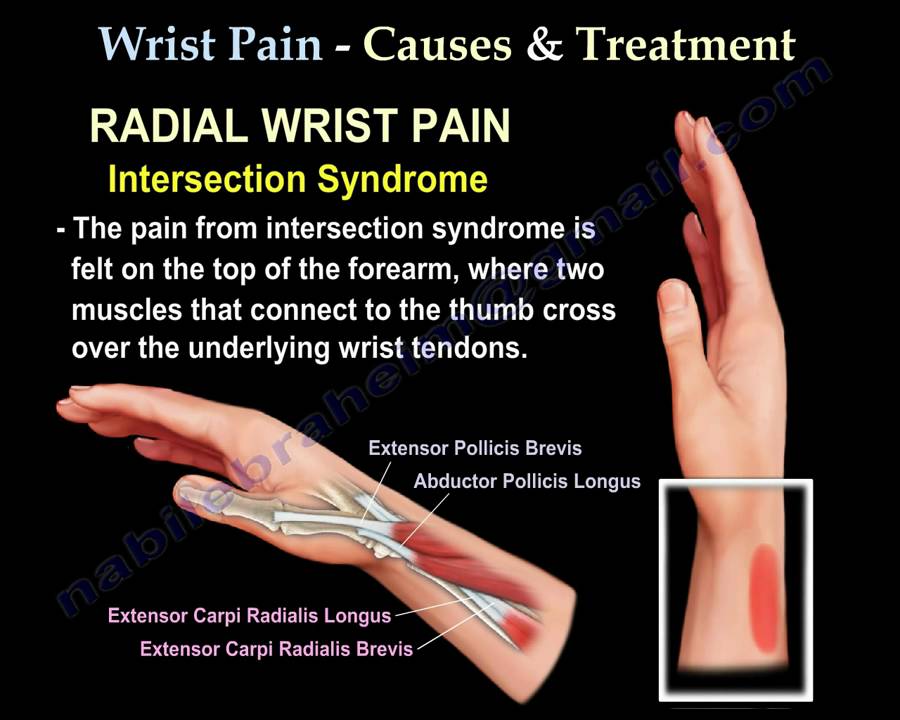 swollen painful wrist joint pirmas sąnarių skausmas