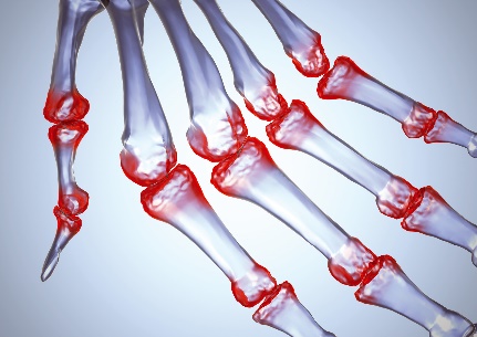 edema in knee joint alergija ligos sąnariai