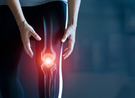 osteoartrito medikamentinis gydymas vaistažolės sąnarių ir raiščių gydymo