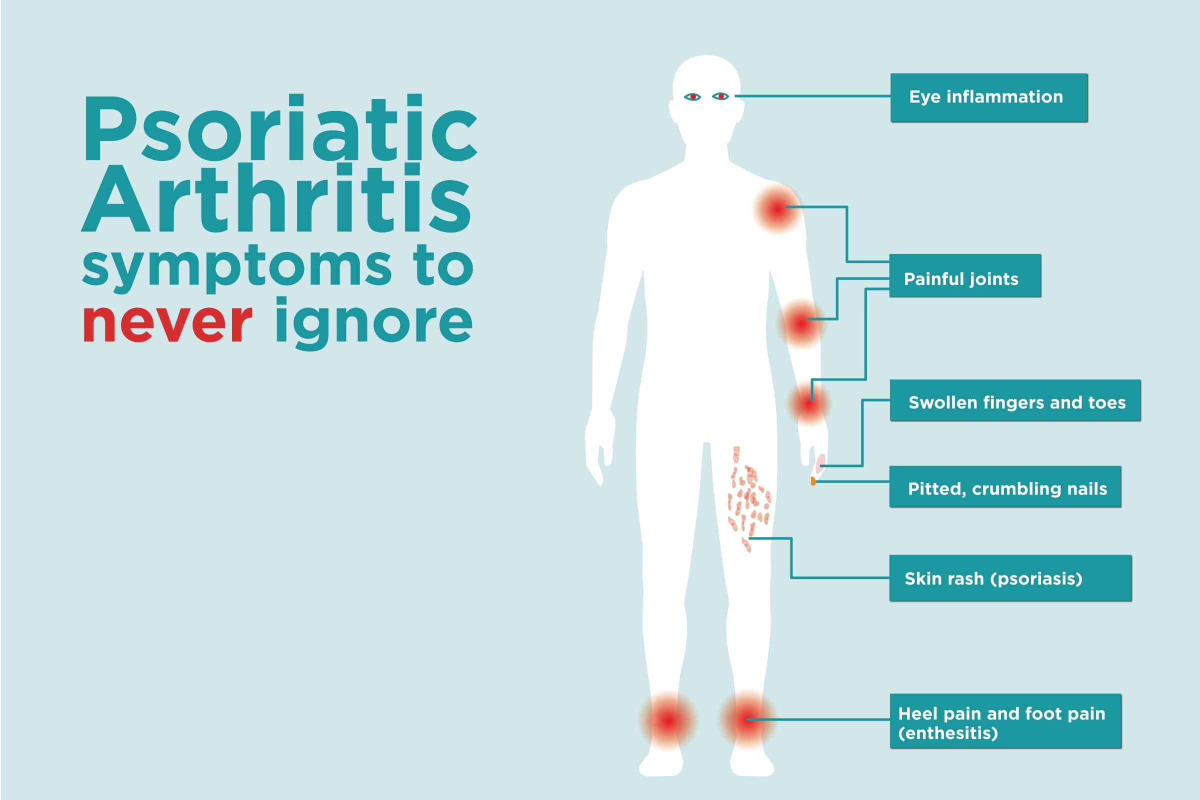 psoriasis artritas simptomai