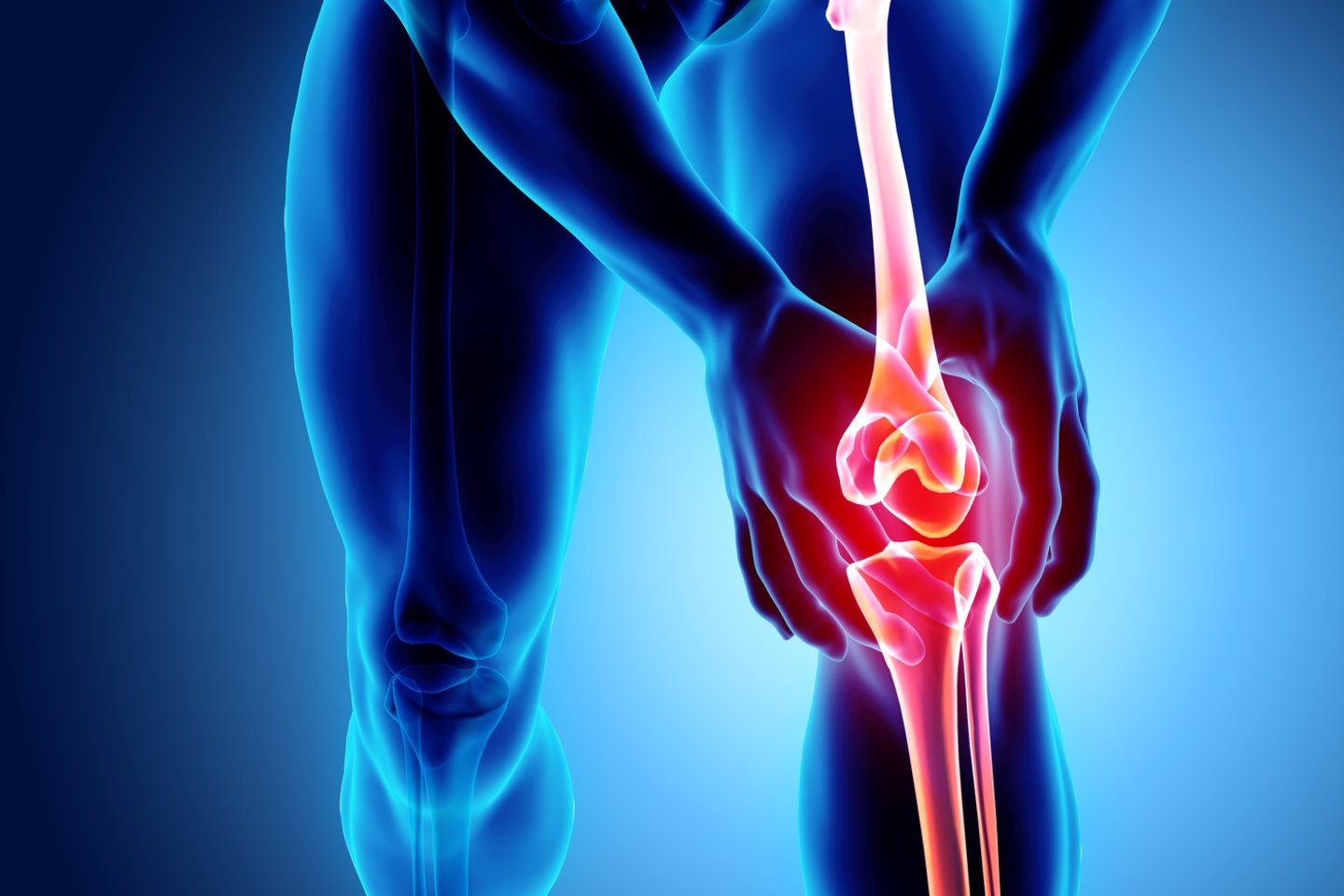 gydymas osteoartrito artrito tradicinius metodus lėtinė artrozė peties sąnario