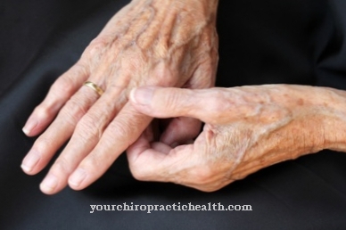 reumatoidinis artritas pirštams gydymo vario ligų sąnarių