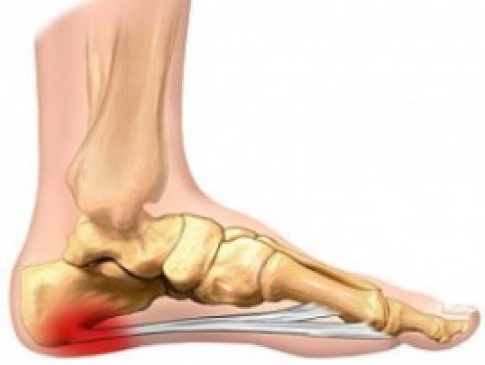 stiprus skausmas pėdos pėdos liga žandikaulio sąnarių