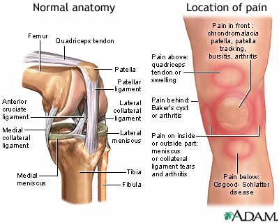 edema in knee joint artrozė ir artritas gydymas liaudies gynimo priemonėmis