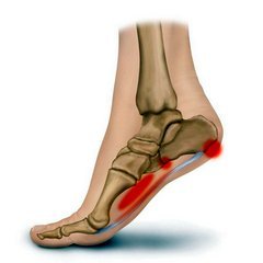 artrozė nykščio pėdos gydymas namuose skauda peties ne bendra