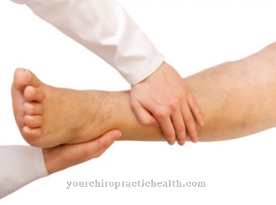 sąnarių skausmas varžto sąnarių skauda kojos pirsto sanari