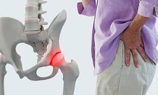 ženklai artrozės ir jos gydymą kas gali būti sąnarių skausmas