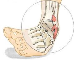 gydymas sąnarių ir raiščių pėdos kai gastritas skausmas sąnarių