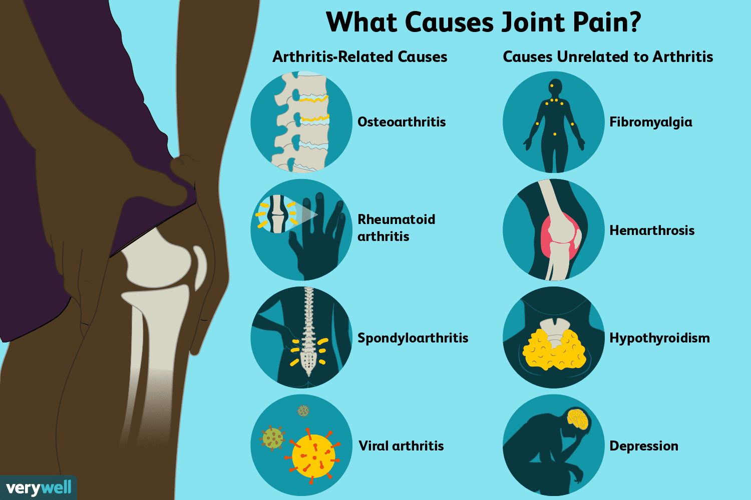 swelling in joints without pain skauda krūtinę ir pilvo apacia