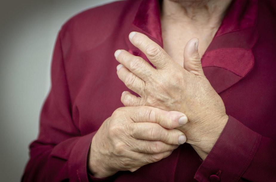 artritas pirštai gydymas tradicinė medicina