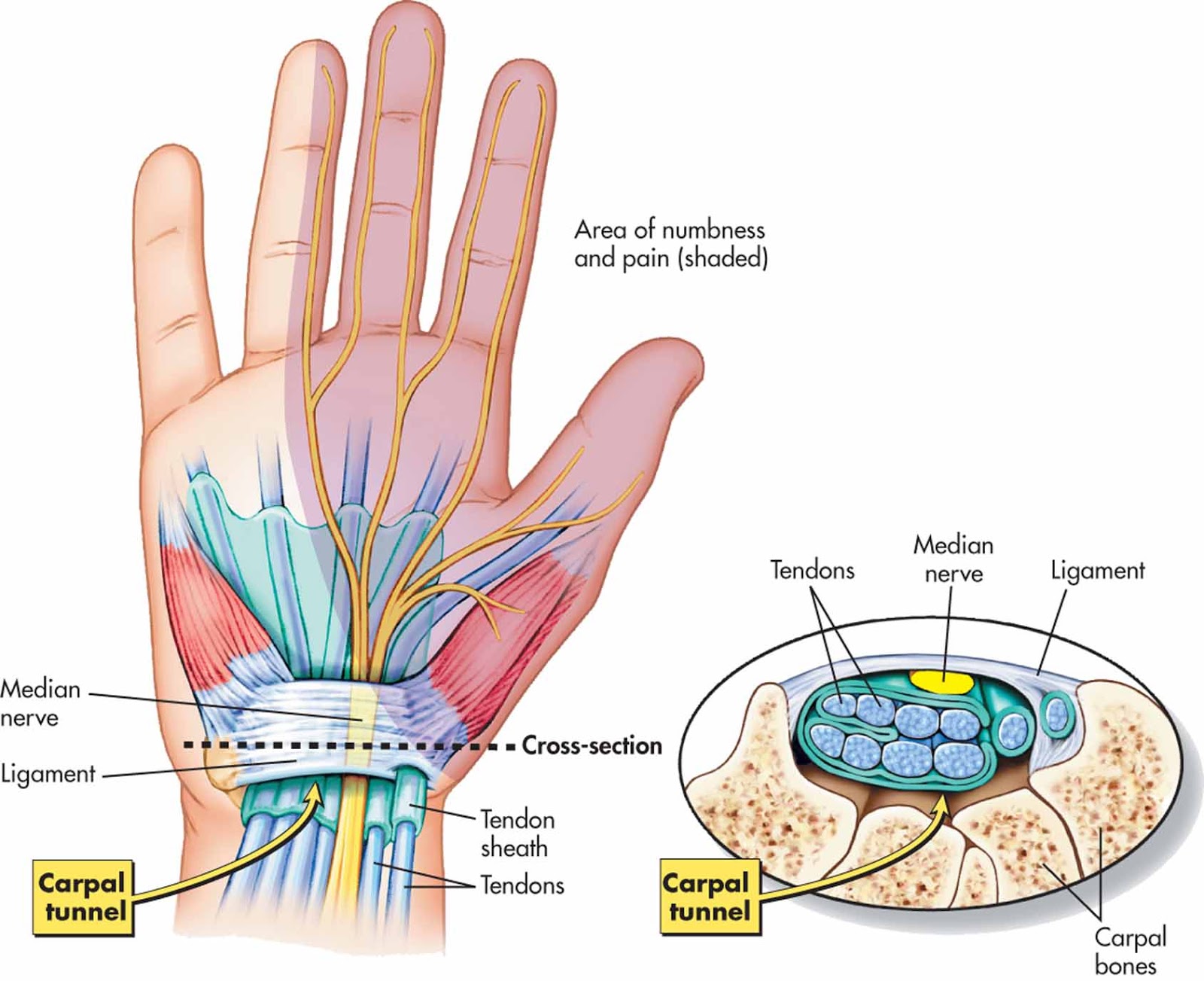 rankų riešo sąnarys artrozė ligos ar jos gydymo
