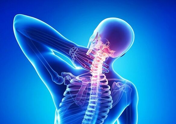 dugootroschatyh artrito sąnarius apatinėje nugaros kaip pašalinti skausmą osteochondrozės liaudies gynimo priemones