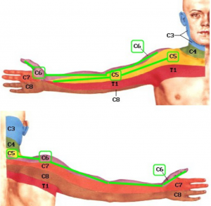 rankų dažytos skausmas fizioterapijos metodai ligų sąnarių