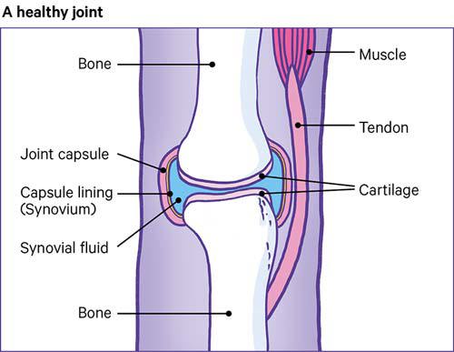 edema synovial joints
