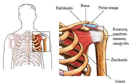 artrozės peiliai gydymas skausmas bendra pečių artrito tepalo