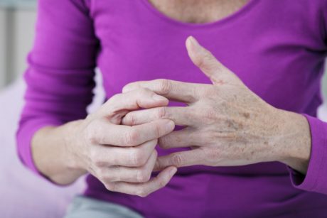 kur artritas šepečiai gydyti
