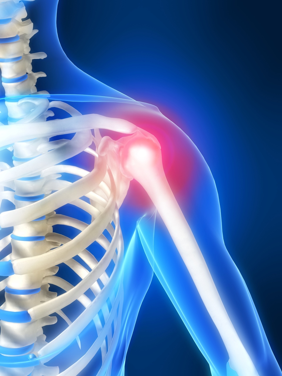 raumenų klajonių skausmas ir sąnarių gydymas klubo osteoartritas
