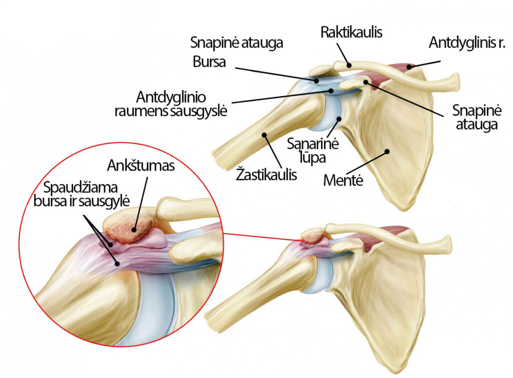 skausmas raumenyse ir apatinės nugaros sąnarių
