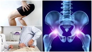 sąnarių skausmas ir raumenų liaudies gynimo gydymas osteoartritu alkūnės sąnario
