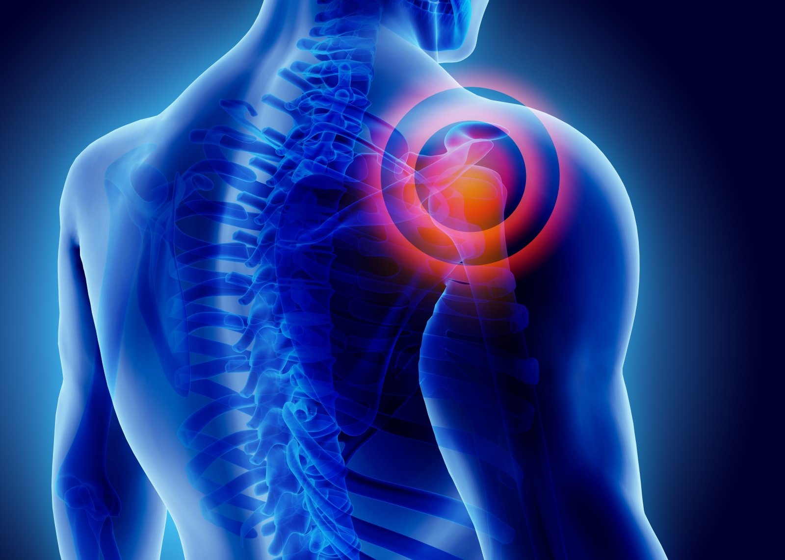 peties sąnarių gydymas skauda kremas nuo skausmo raumenų ir sąnarių