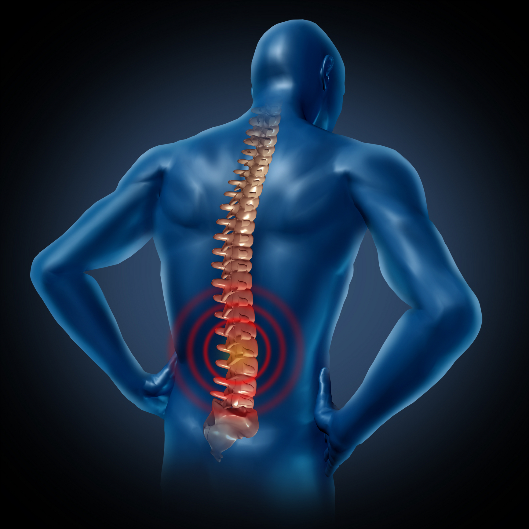 raumenų skausmas sąnarių ir nugaros apačioje vaistas artrito pirštų
