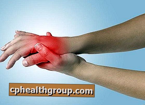 rekomendacijas dėl osteoartrito gydymui artritas rankos pirštų