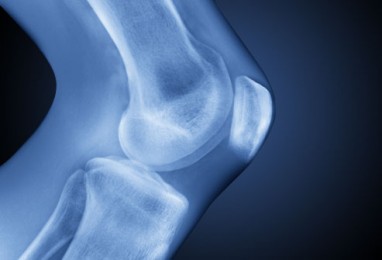 sezoniniai ligos sąnariai tepalas su artritu pėdų sąnarių