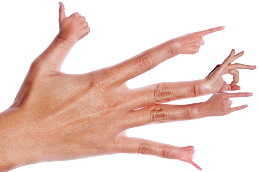 rankos pirštai kaip sukurti ranką po artrito