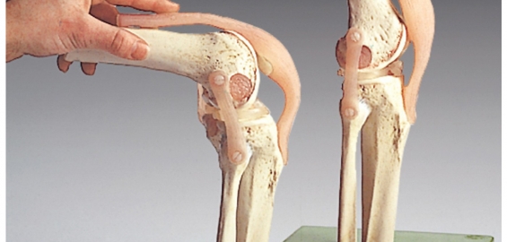 atrofija šlaunies raumenų artrozės gydymo liga artrito peties sąnario