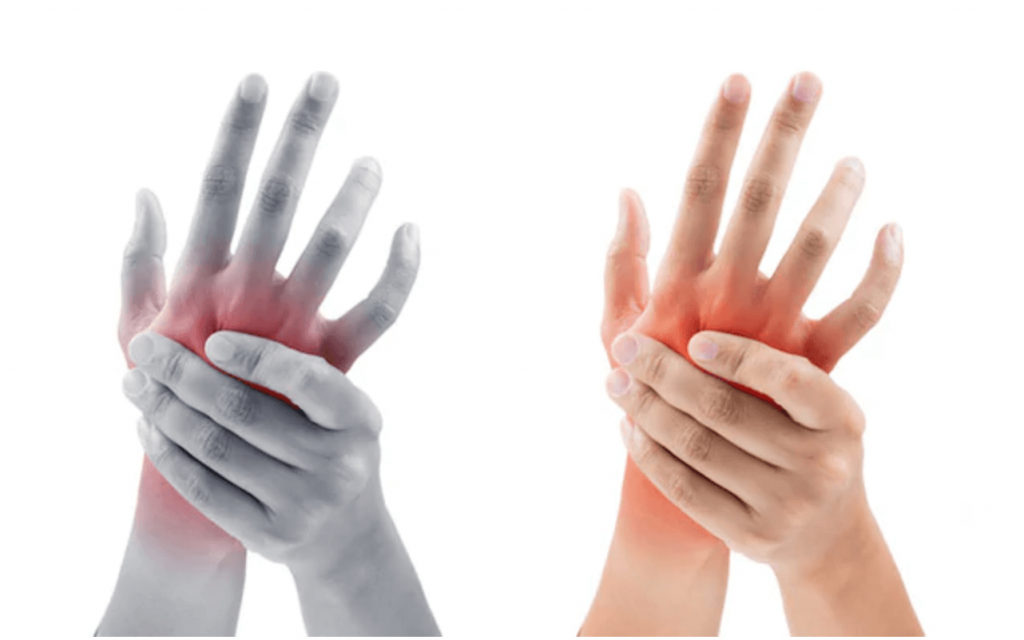 rankos pirštai kas yra artrozė 2 laipsnių peties sąnario