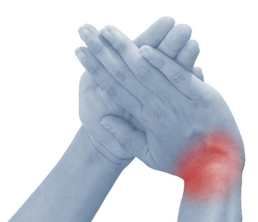skauda rankos rieso sanario tabletės skausmas arkoxy sąnarių