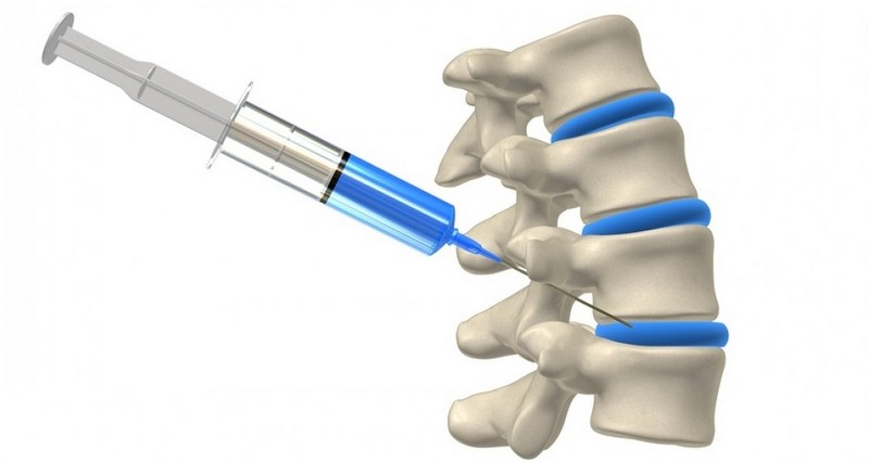 homeopatiniai įrankiai iš osteochondrozės dažnas šlapinimasis sąnarių skausmas