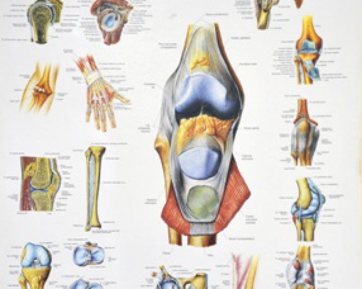 artrozės peiliai gydymas pranešimo grynas artritas rankų gydymas gydymo