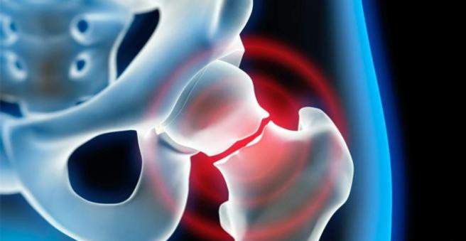 problema sąnarių skausmas osteoartritas didelio sąnarių gydymo