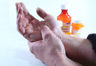 artrito pirštais homeopatija