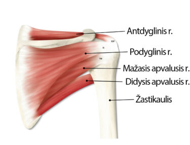 artritas iš riešo sustav rampa-m per peties sąnario artrozės